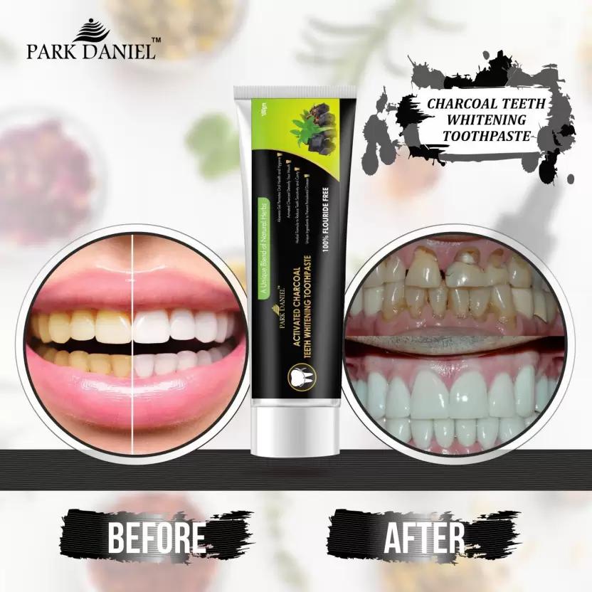 PARK DANIEL Natural Activated Charcoal Teeth Whitening Toothpaste - For Tobacco Stain, Tartar, Gutkha Stain and Yellow Teeth Removal | No Side Effect (100gm) Toothpaste (100)